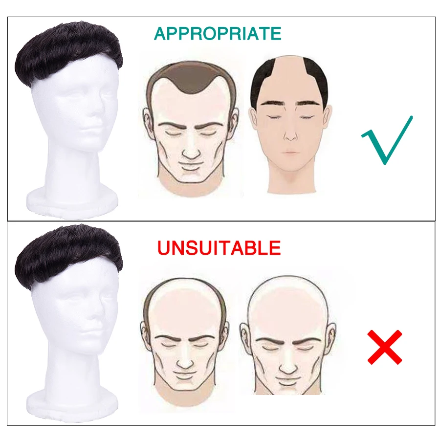 Alileader дешевые 200 г/упаковка мужские волосы заменить Мужские t на заколках 150%