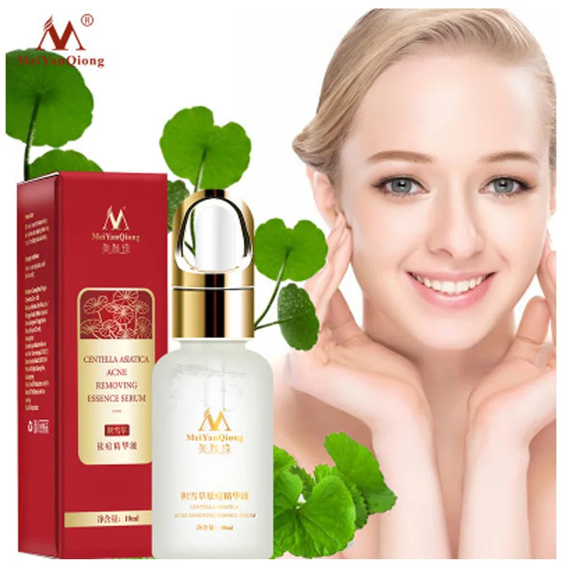 

Beauty Qiong Centella acne-marking essence Acne serum 10ml moisturizing and moisturizing facial treatment