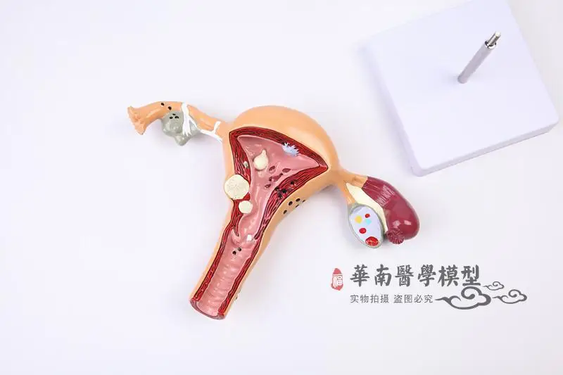 Модель женской анатомии модель репродуктивной матки вагинальный яичников форма