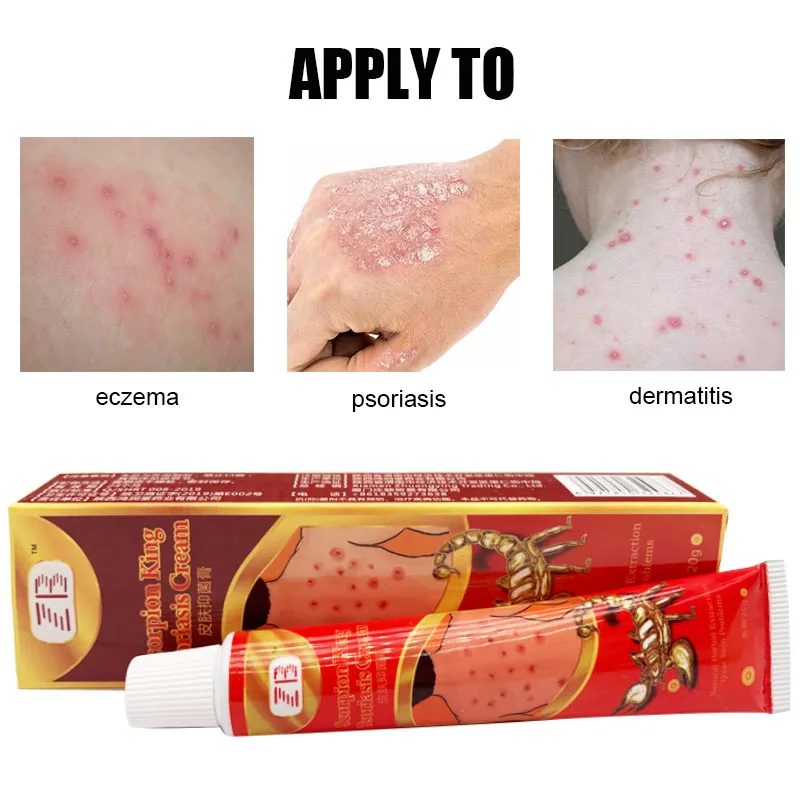 20G Scorpion Venom Extract Skin Anti-Itching Cream Psoriasis Ointment Treatment Dermatitis Eczematoid Eczema Care Plaster | Красота и