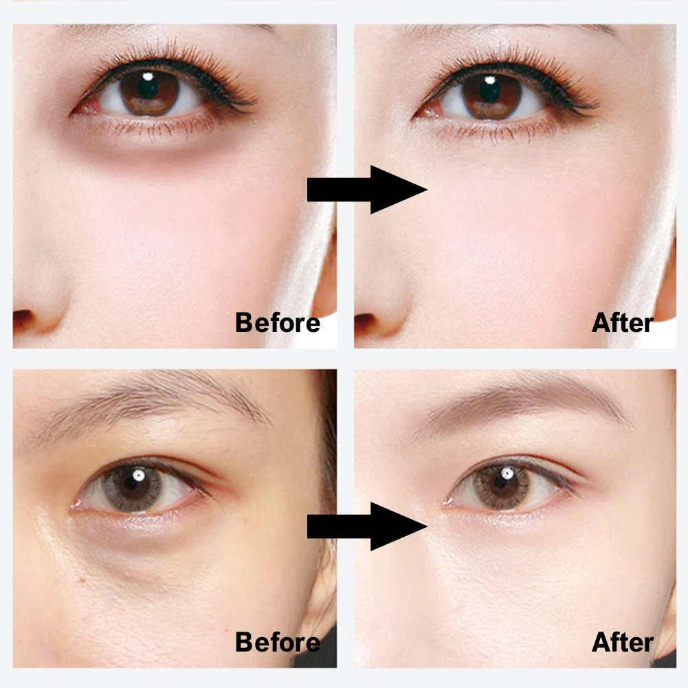 

Under Eye Patches Eye Masks For Dark Circles And Eye Bags Improve Puffiness Moisturize Skin Masks 30 Pairs Under Eye Patch