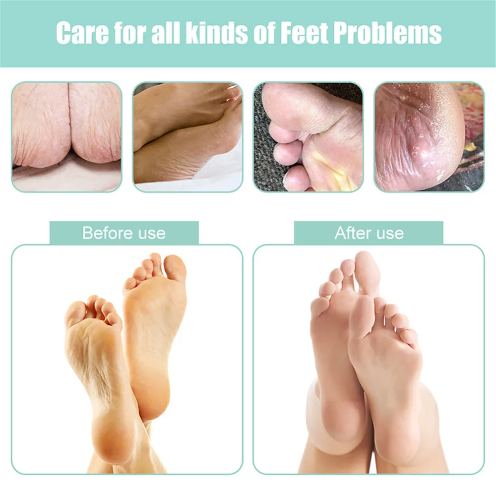 New Usb Charged Electric Foot File For Heels Grinding Pedicure Tools Professional Care Tool Dead Hard Skin Callus Remover | Красота и