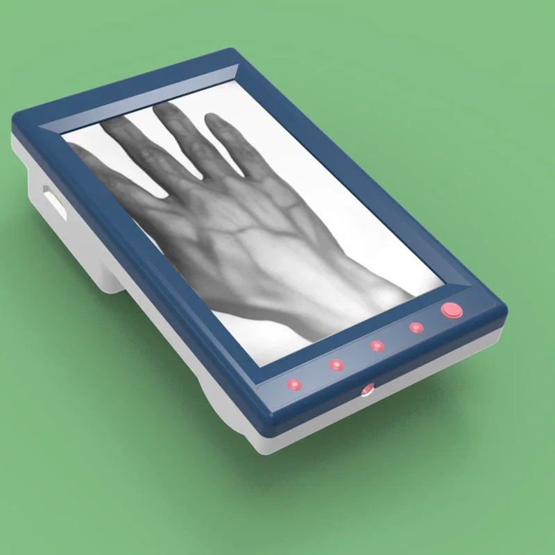 

Medical Vein Imaging Device Veinpuncture Using Vein Viewer Vein Finder