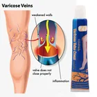 Медицинский пластырь ZB для лечения варикозного расширения вен, 20 г
