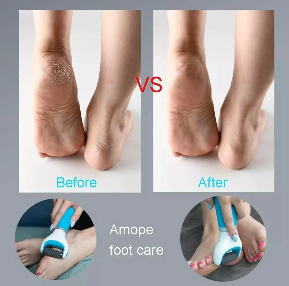 Electric Foot File USB Pedicure Machine Pink Blue Hard Dry Dead Cuticle Skin Remover Care Tool | Красота и здоровье
