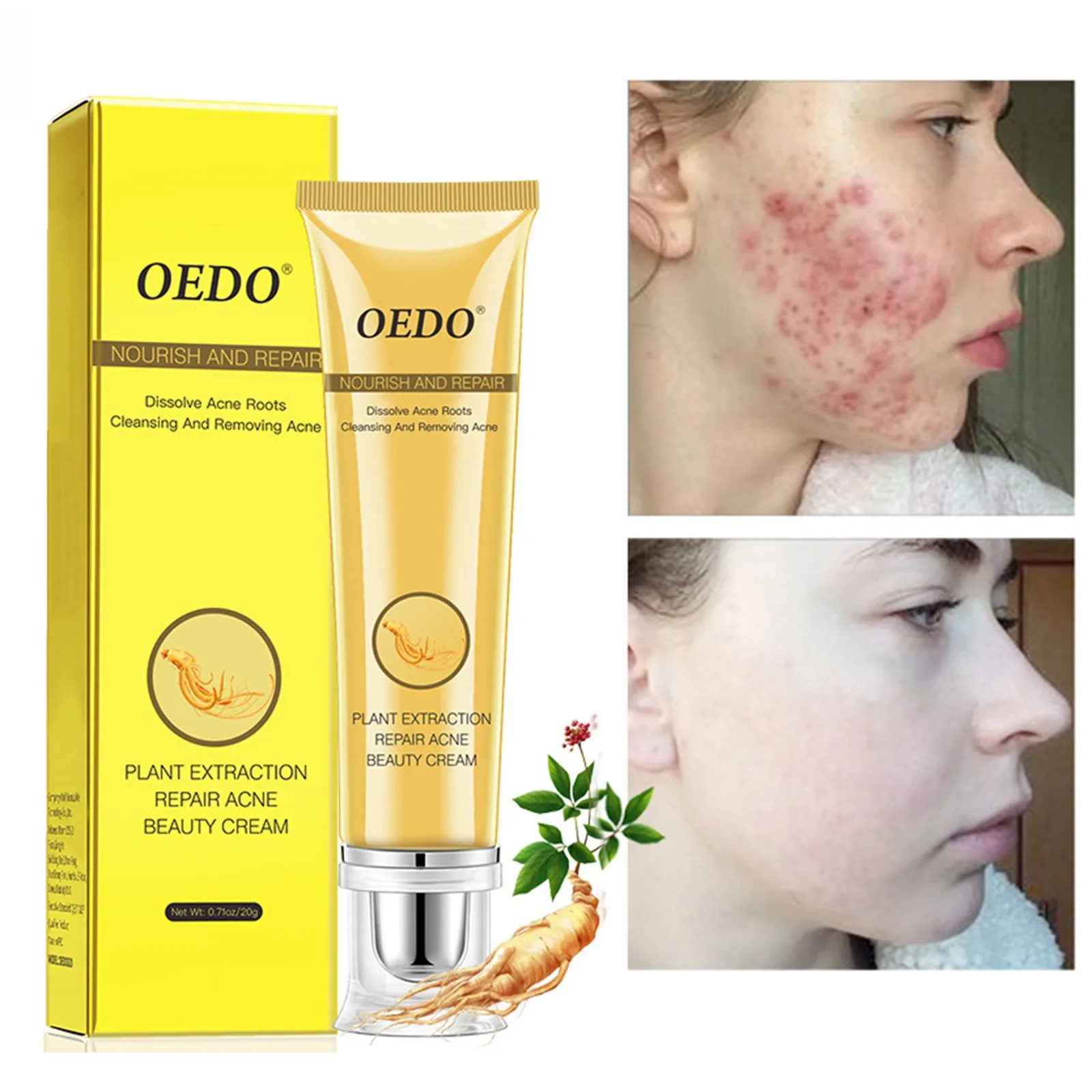 HAICAR личный уход за кожей крем от акне Восстанавливающий экстракт растений