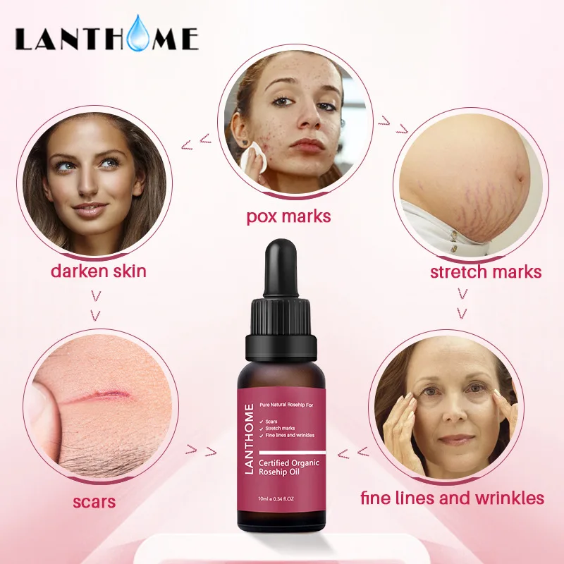 

Pure Organic Rosehip Oil Antioxidantfor Scars Fine Lines Wrinkles Stretch Marks Improve Skin Elasticity Firmness