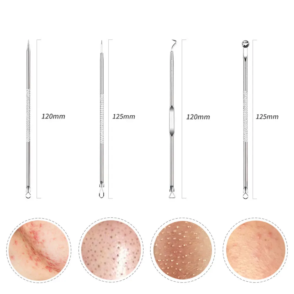 Инструмент для удаления чёрных точек на лице из нержавеющей стали |