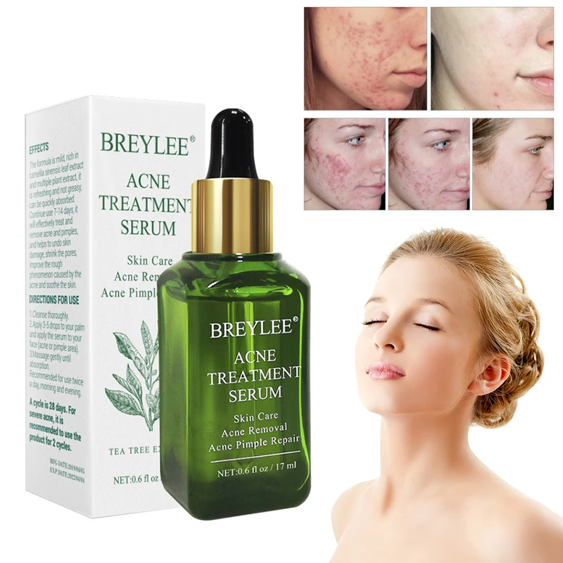 

1PC Acne Treatment Serum Facial Essence Anti Acne Scar Removal Face Cream Pimple Patch Skin Care Remover Acne Cream TSLM2