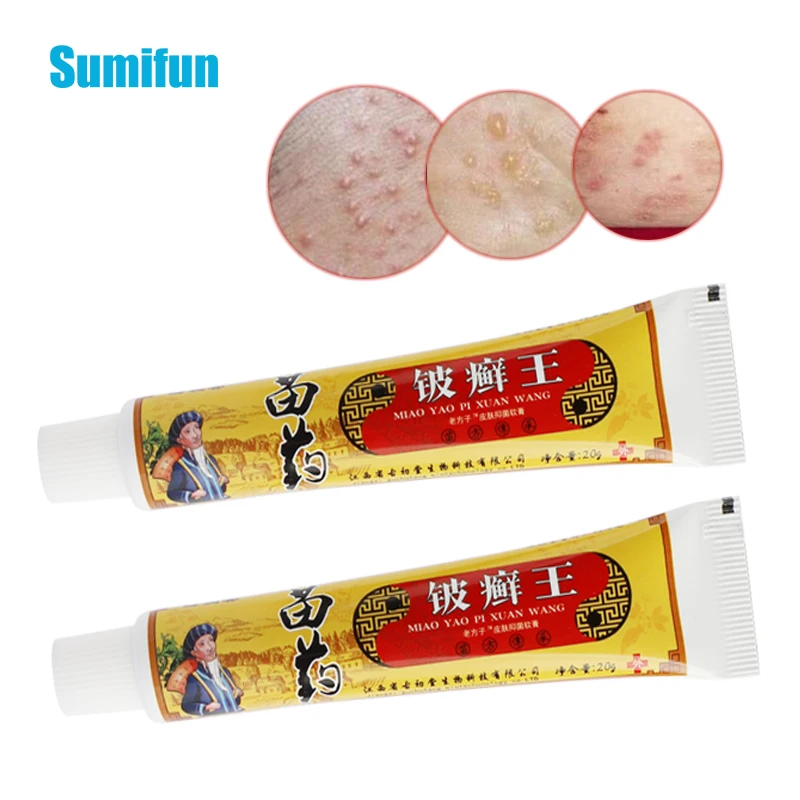 

1Pcs Chinese Antibacterial Ointment Psoriasis Antipruritic Eczema Dermatitis Treatment Cream Anti-Itching Herbal Medical Plaster