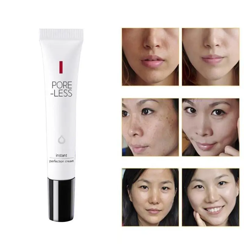 20g Acne Cream Delicate Repair Acne Scar Marks Shrink Face Control Acne Oil Moisturizing Beauty Remove Cream Pores J1A7