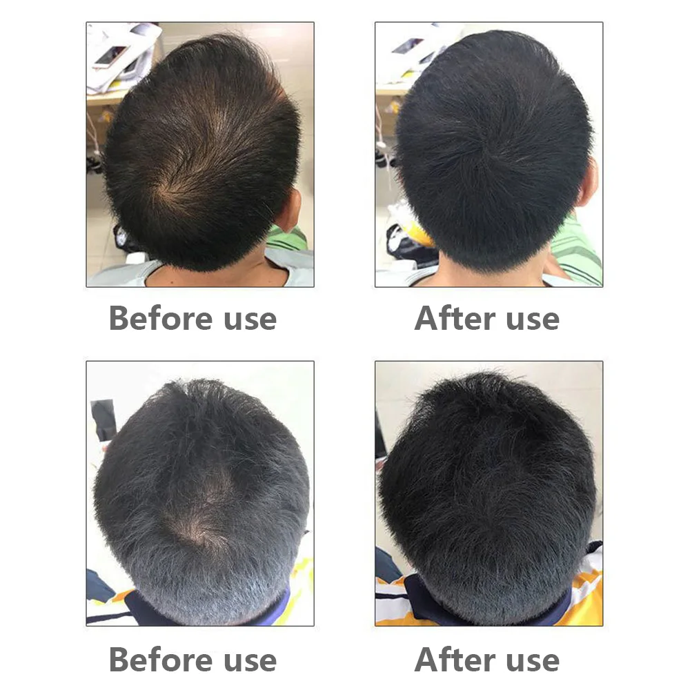 Одноразовые волокна для роста волос Кератиновый спрей выпадения белый