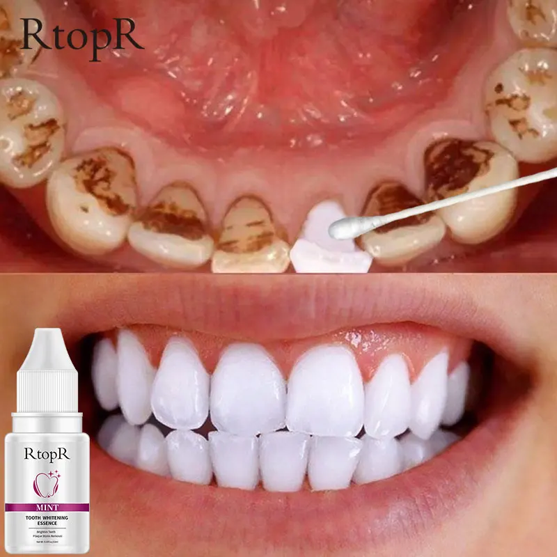 

Teeth Whitening Serum Oral Hygiene Removes Plaque Stains Treatment Essence Daily Use Effective Teeth Cleaning Liquid Dental Care