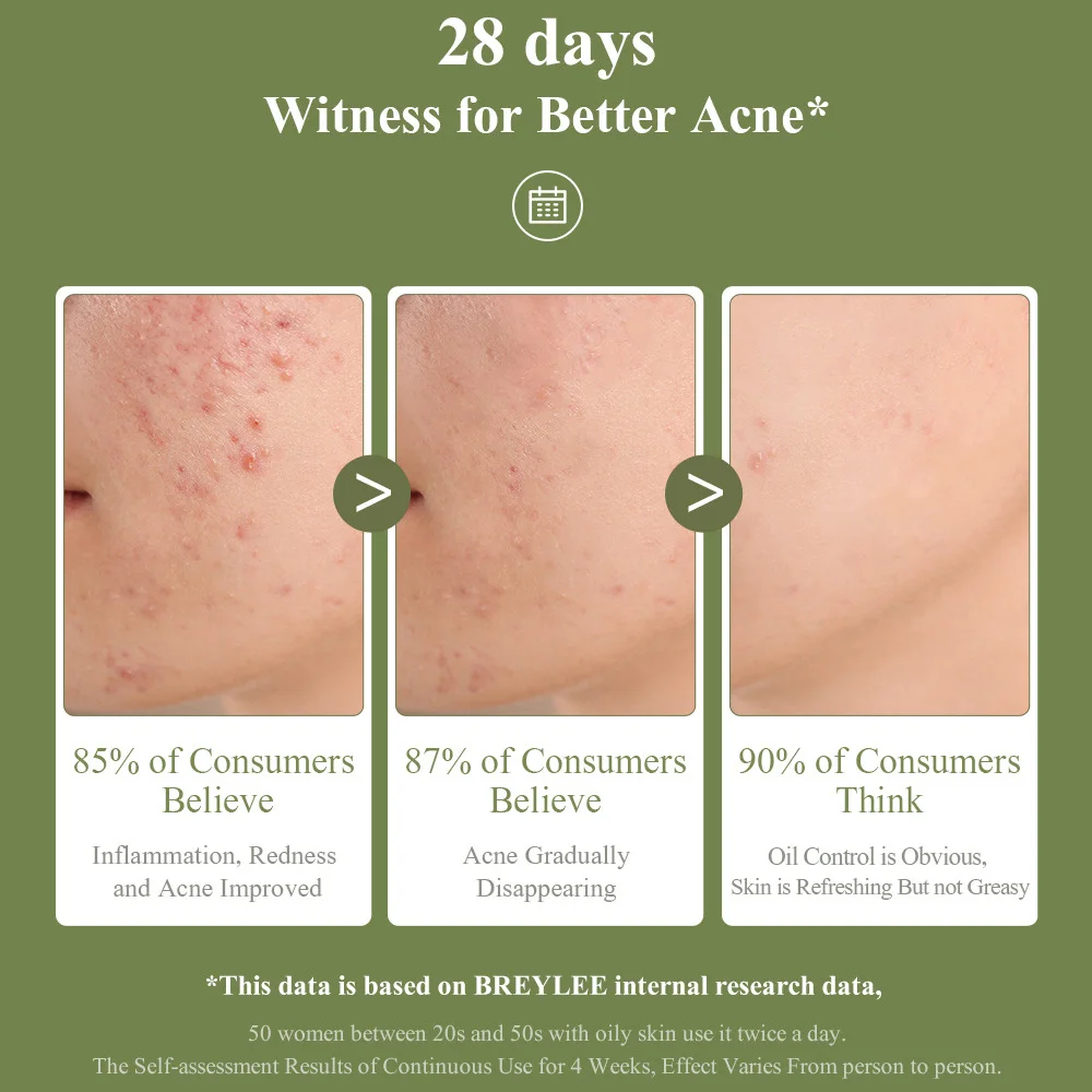 

Pure Salicylic Acid Face Gel Anti-Aging Acne Rosacea Clear Pores for Oily Skin Acne Removal Cream 15g @ME