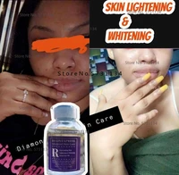 skincare rejuvenating skin lightening whitening bleaching serum face oil for hyperpigmentation