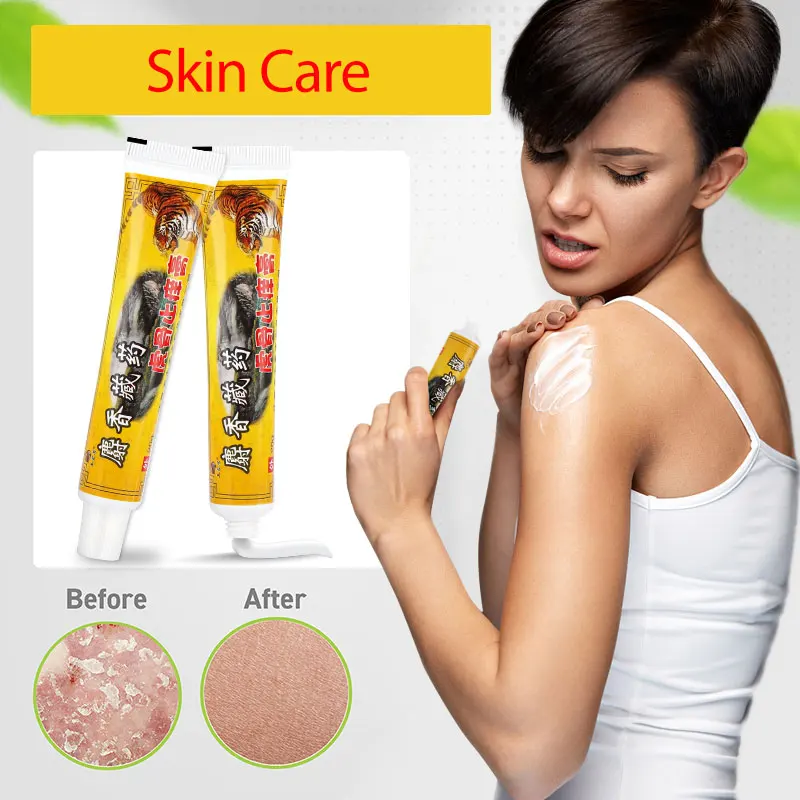 Мазь Тигровая для псориаза дерматита антибактериальная мазь снятия симптомов