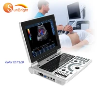 cheap portable color doppler 2d ultrasound machine portable scanner echographe france