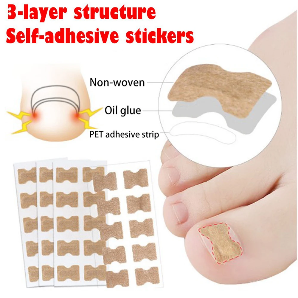 10 шт. корректор для вросших ног с двусторонней лентой|Инструмент ухода за