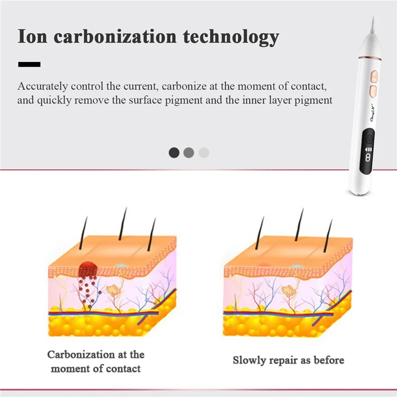 

Ckeyin Lcd Display Laser Mole Removal Pen Wart Plasma Remover Beauty Skin Care Corn Freckle Tag Nevus Dark Sweep Spot Tattoo