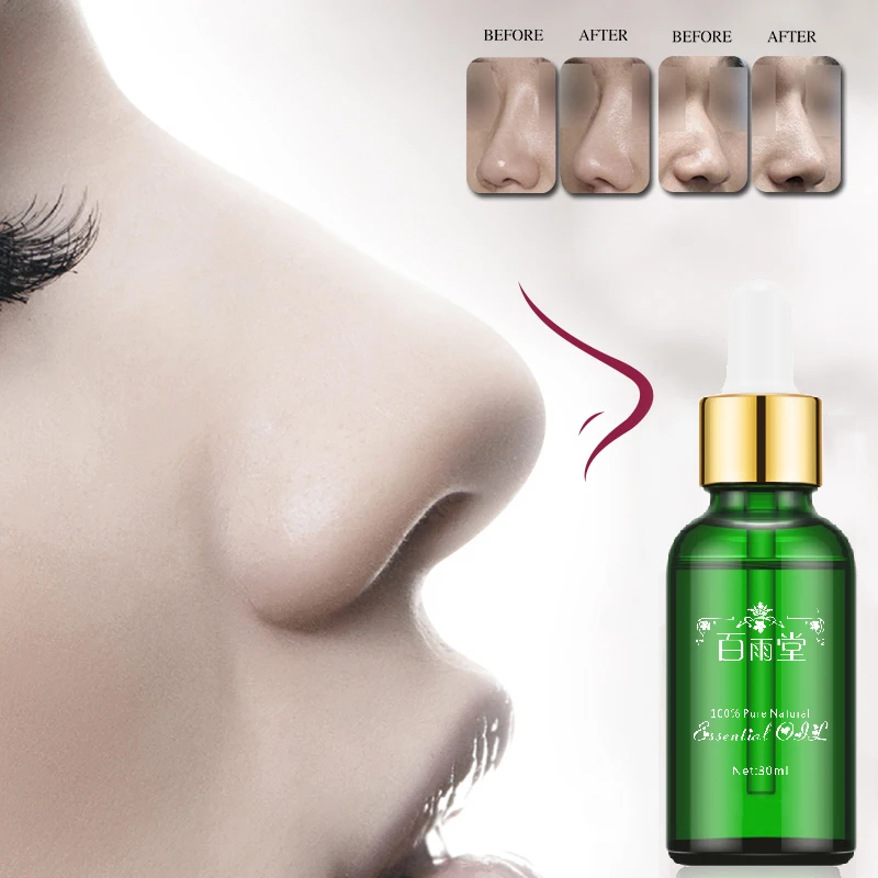 

Эфирное масло для ринопластики, 30 мл, восстановление формы носа, чистый натуральный уход за носом, тонкий нос, эффективность 100%