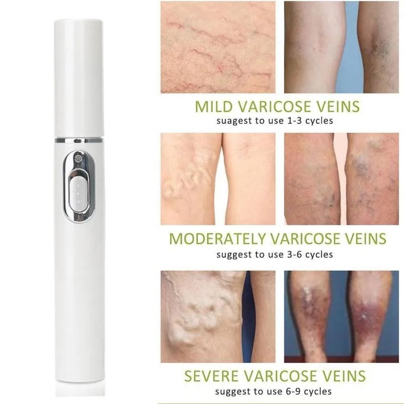 

Medical Blue Light Therapy Pen Varicose Veins Treatment Scar Removal Treatment Wrinkle Acne Soft Scar D0K4