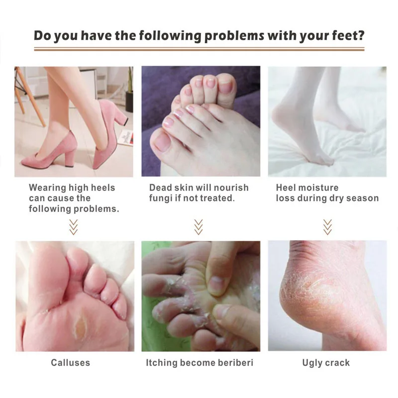 Электрический аппарат AD Electric для удаления пяток и мозолей 2000 мАч USB зарядка пилка