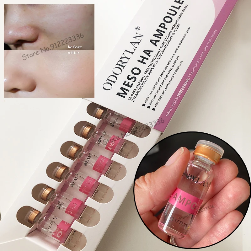 

Mesotherapy Hyaluronic Acid Ampoule 5ml Cross-linked HA Skin Whitening Serum for Wrinkle Ance Remove Anti-aging Skin Care cream
