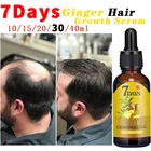 Сыворотка Имбирная прорастающая эфирное масло, 7 дней, натуральное средство против выпадения волос, эффективный быстрорастущий Уход за волосами, 30 мл