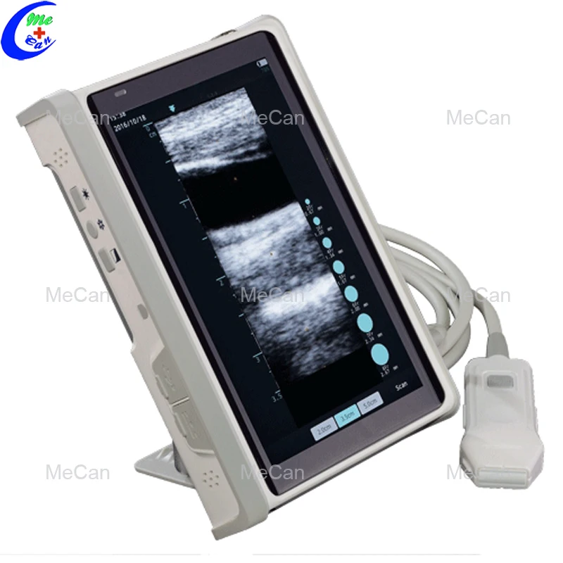 

Portable ultrasound device for hospital