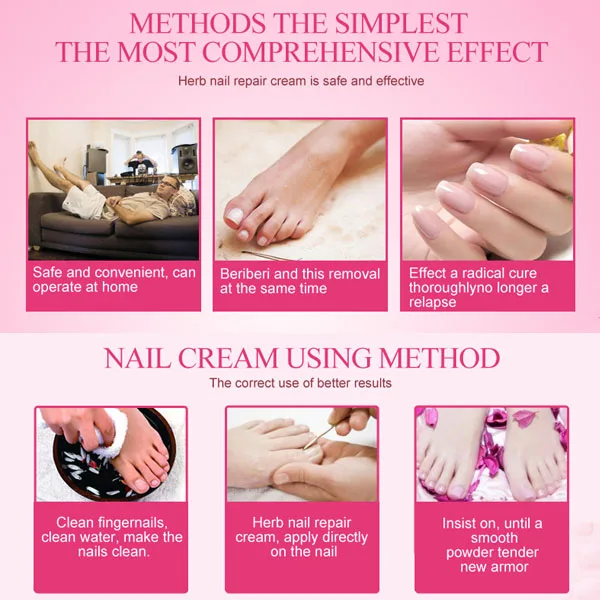 

High Quality Nail Foot Protector Skin Care Cream Nail Fungus Treatment Herb Nails Repair Cream Nail Care Tools