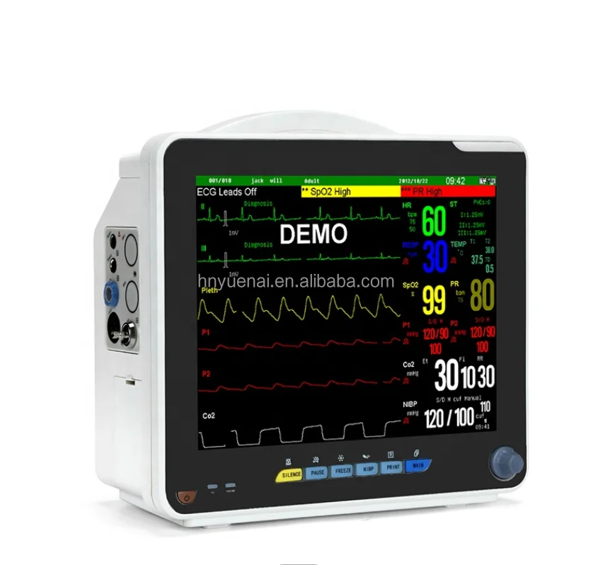 

Blood pressure monitor