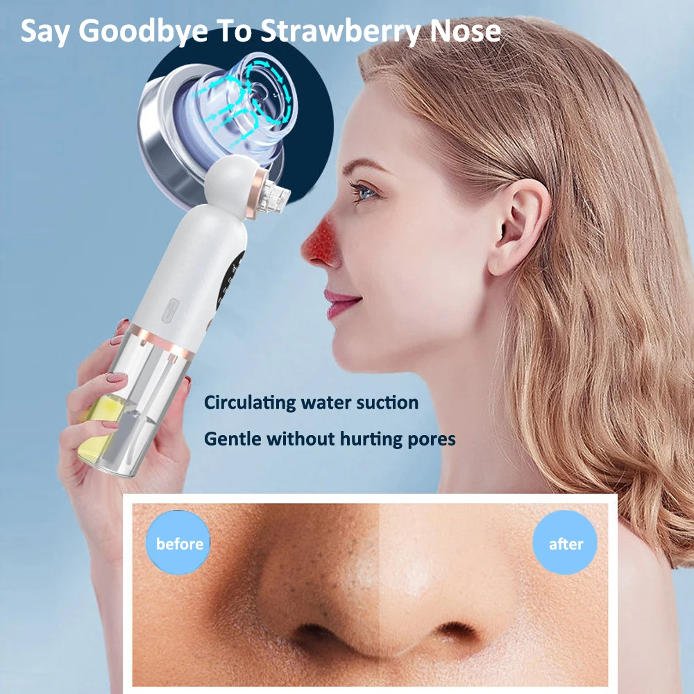 Средство для удаления черных точек на лице вакуумный аппарат глубокого очищения