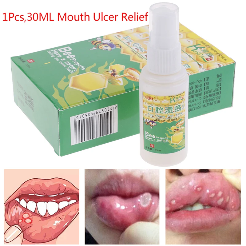 

30ml Natural Herbal Mouth Freshener Spray Bee Propolis Antibacterial Oral Spray Oral Ulcers Toothache Bad Breath Treatment