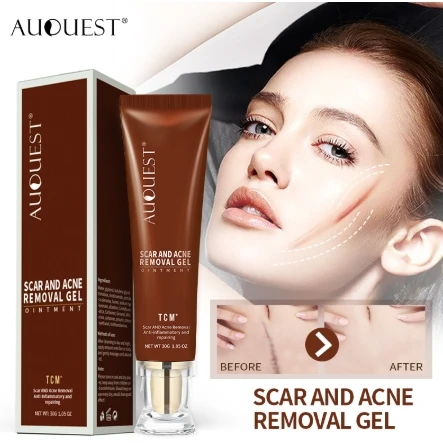 Мазь TCM для лечения акне и удаления шрамов гелевая мазь следы от черных точек