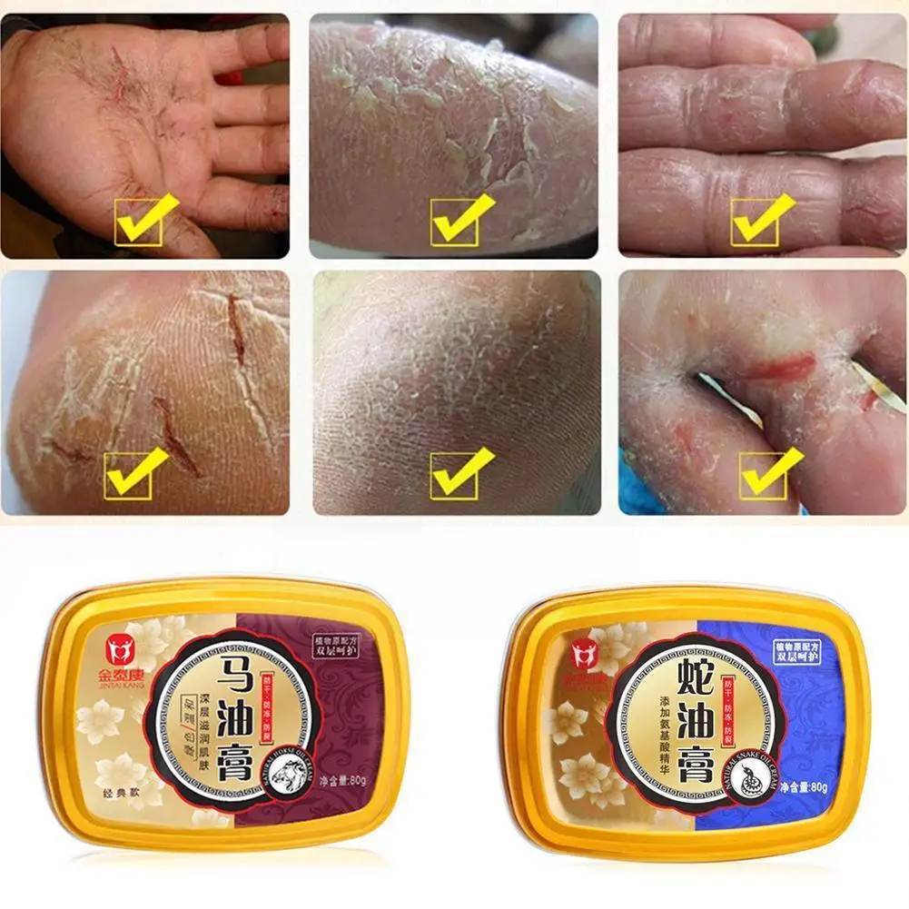 

Snake Oil Horse Ointment Hand & Foot Cream Hand & Foot Anti-chapping Skin Care Cream Antibacterial Whitening Care Nourishin G8D9