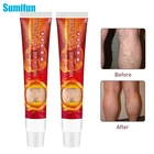 SMF 20g мазь для варикозных вен Spider Cream расширения вен ангиит для удаления масла васкулита флебит из трав, медицинская штукатурка