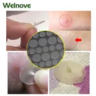 3672108pcs инструмент для удаления прыщей Стикеры против акне угрей лечение штукатурка акне прыщи патч маска Инструменты для ухода за лицом, уход за кожей, D2668