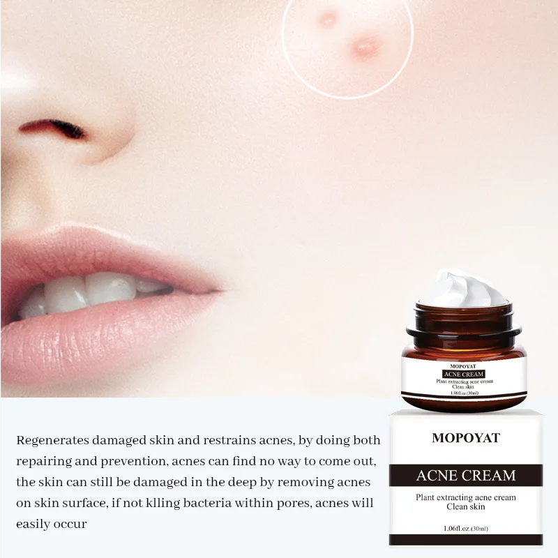 30 г крем от акне лечение угрей сокращение пор ремонт удаления контроль шрамов