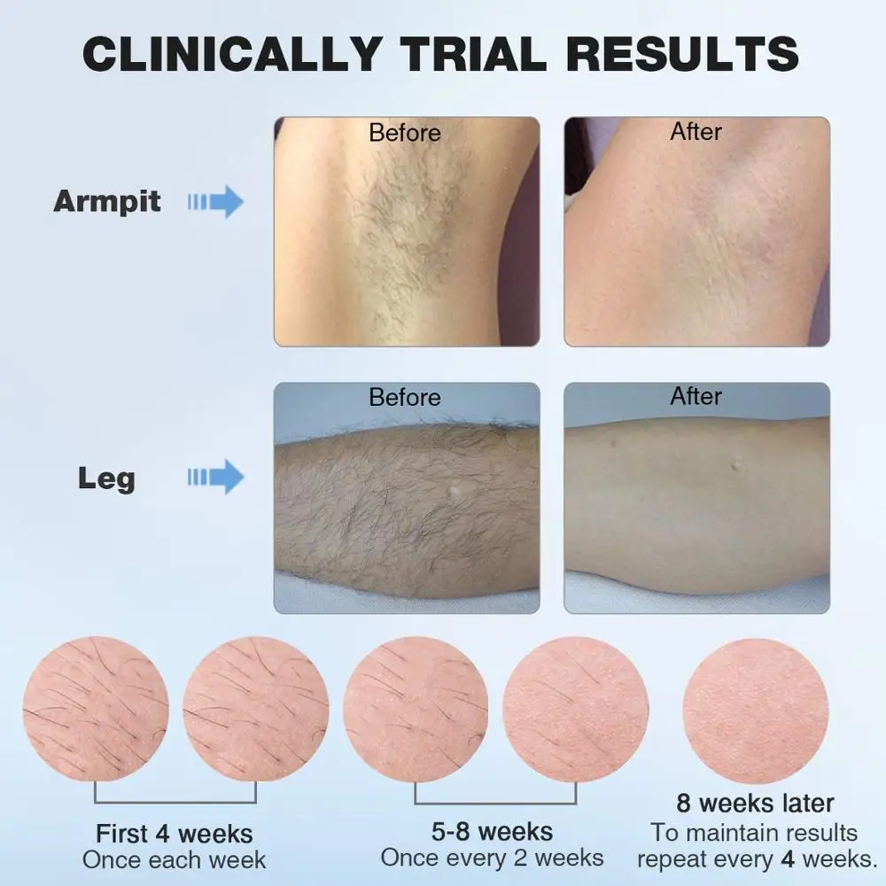 

mlay laser T4 Laser hair removal device Laser hair removal ICE Cold IPL Epilation Flashes 500000 mlay ipl hair removal painless