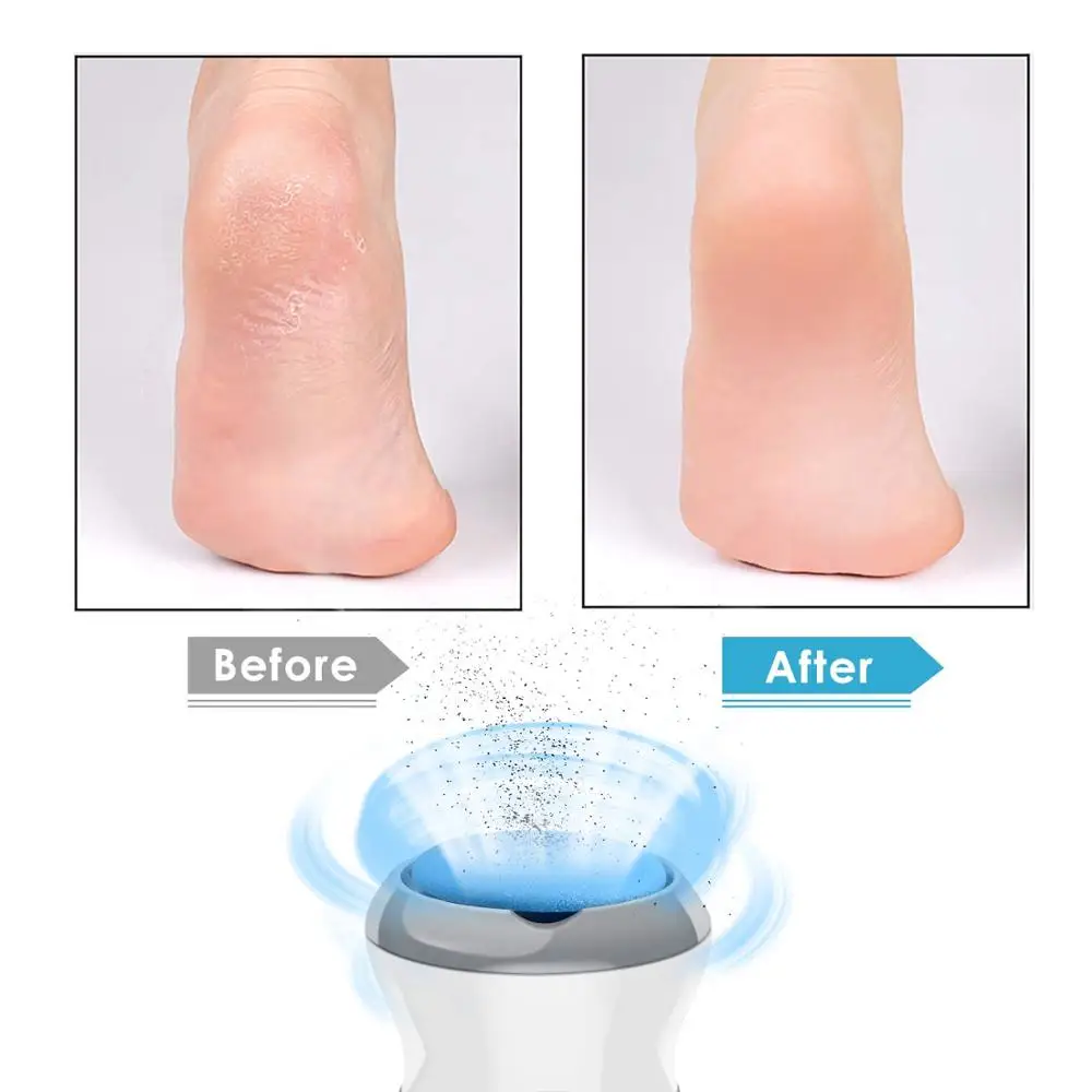 

Callus Remover For Feet Rechargeable Portable Pedicure Foot File Grinder Scraper Electric Vacuum Adsorption 3 Grinding Heads