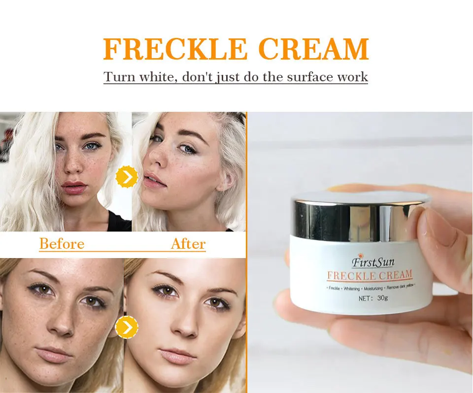 

Repair Acne Cream Anti Spots Acne Treatment Scar Blackhead Cream Freckle Cream Whitening Moisturizing Face Skin Care