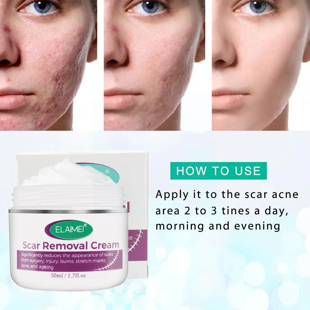 

50ml Scar Removal Cream Moisturizing Stretch Marks Acne Repair Scars Cream Relief Mark Burns Removal Acne Repair Cream K9Y6