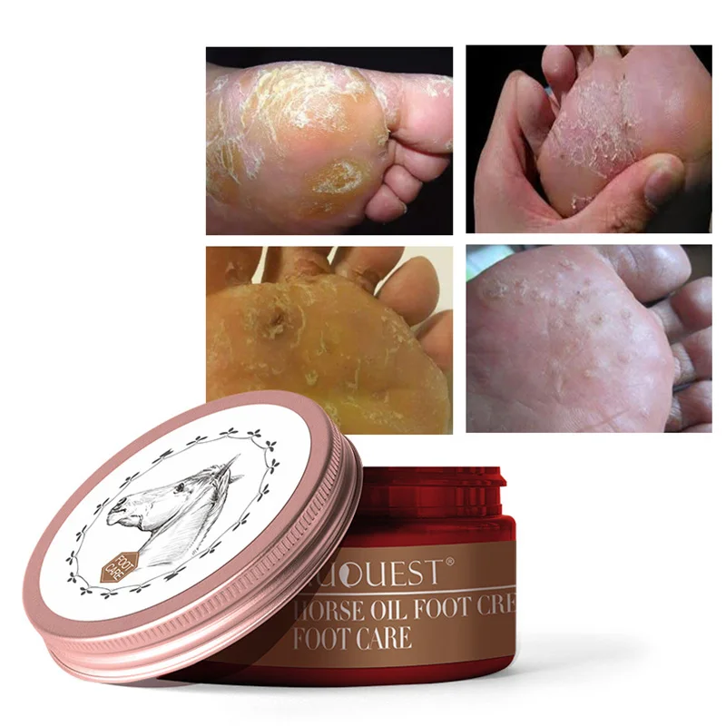 

Horse Oil Foot Cream Moisturizing Anti-chapping Anti-fungal Smoothing Feet Care M88