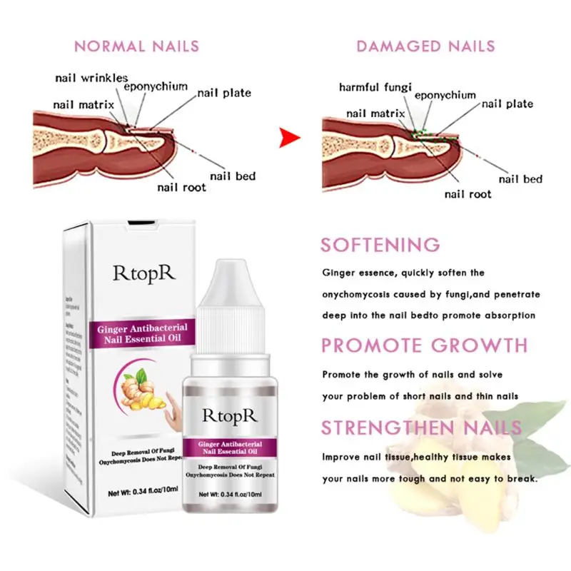 Антибактериальное средство для лечения Ногтей RtopR Ginger онихомикоз паронихия