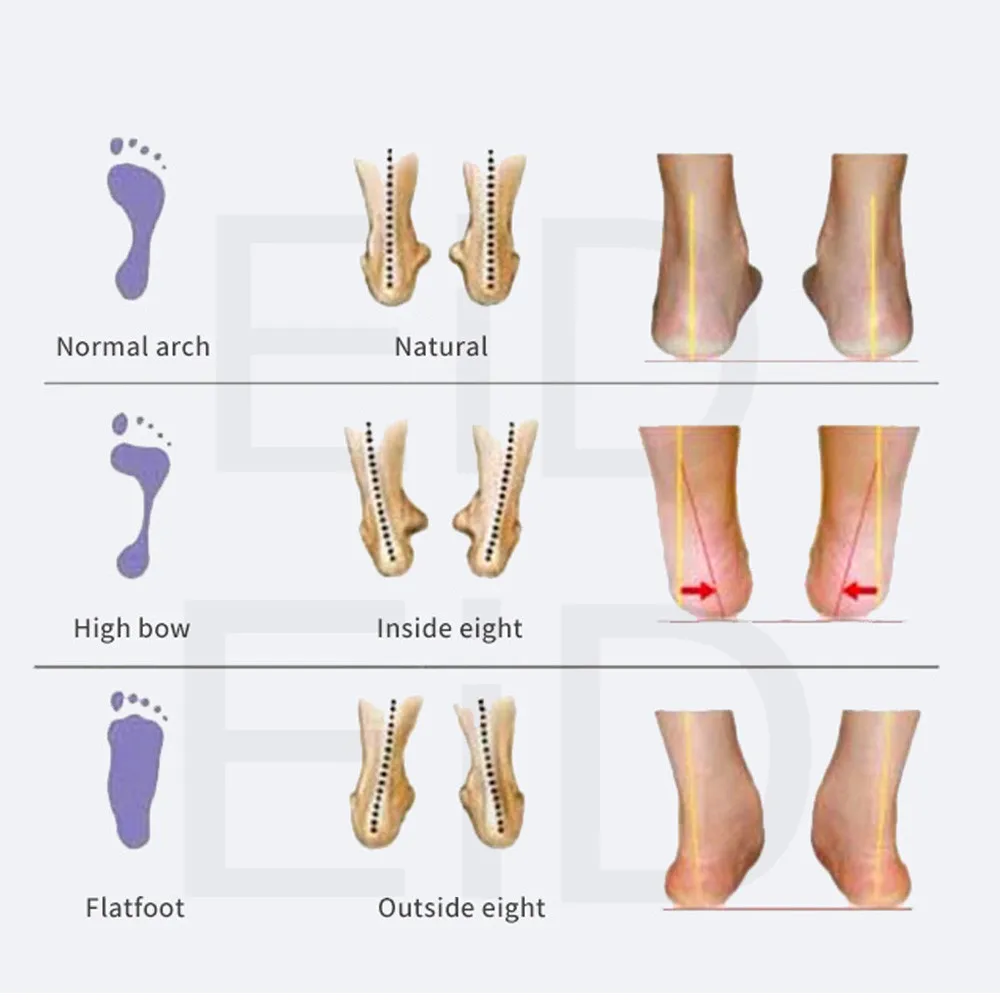 5D High quality Strong orthotic insole for Flat Feet high Arch Support orthopedic shoes sole Insoles for men and women OX Leg