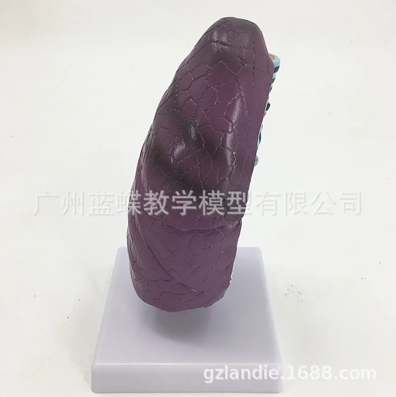 Медицинская модель медицинской анатомической патологии дыхания и легких| |