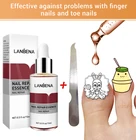 Жидкость для восстановления ногтей от грибков LANBENA, средство для ухода за ногтями, пилка для восстановления ногтей, удалитель, гель для удаления паронихии и онихомиcosistslm1