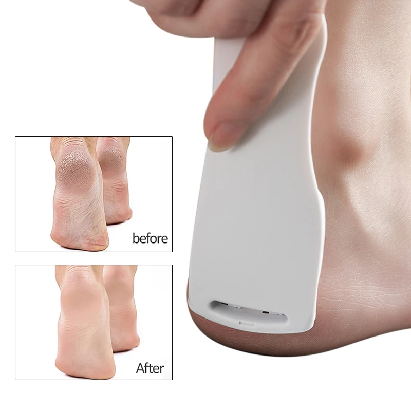 

Foot Pedicure Tools Callus Remover Stainless Steel Foot Scraper Foot Care Tool Cuticle Kit File Set Dead Skin Remover