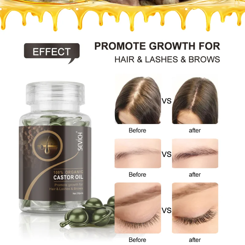 New Hair Loss Nourishing Serum Vitamin Capsule Ginger Silky Repair Damage Anti Treatment Damaged |