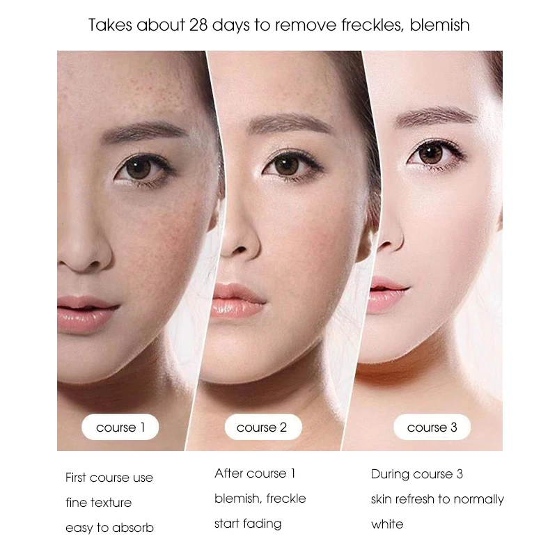 Отбеливающий крем ianna для удаления акне коррекции черно-желтой кожи веснушек